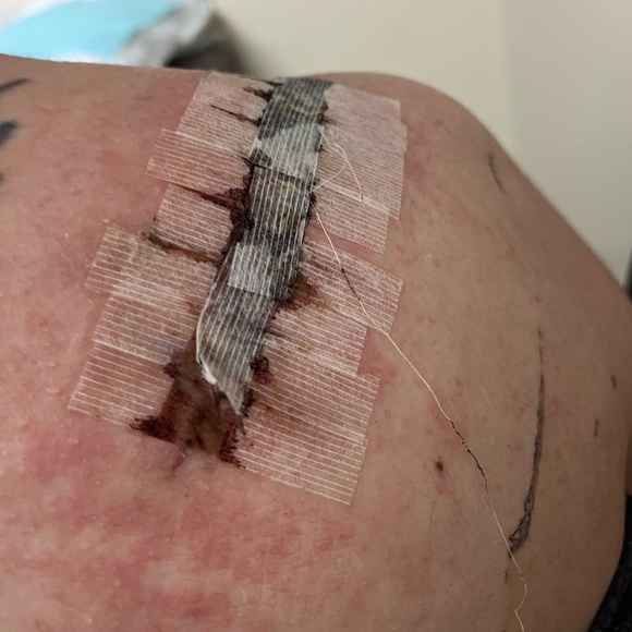 Waiting on next specialist🧿Malpractice Complications🧿 - Picture 2 of 11